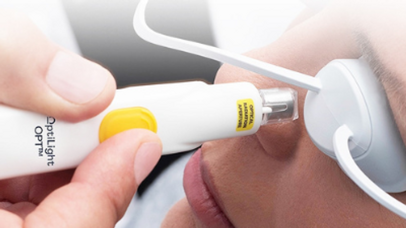 Lumenis Optilight IPL